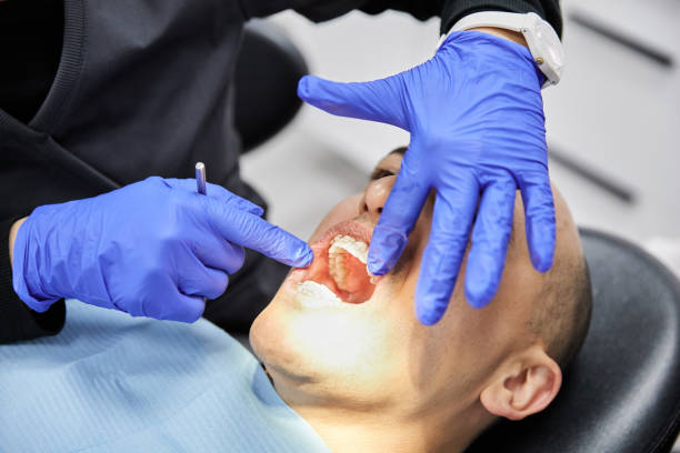 Best Emergency Dental Care for Broken or Chipped Teeth in Horseheads North, NY