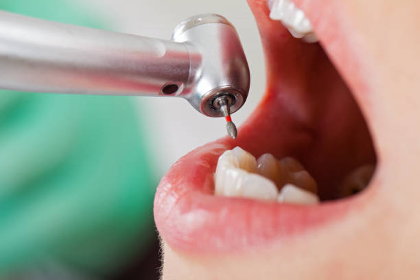 Best Urgent Care for Lost Fillings or Crowns in Horseheads North, NY